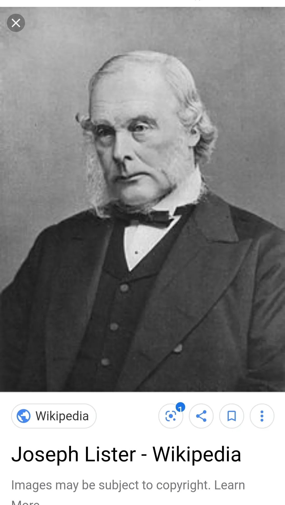 Joseph Lister